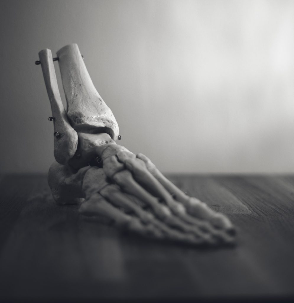 Types of Ankle Injury Treatment